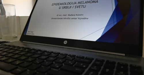Epidemiologija melanoma u Srbiji i svetu